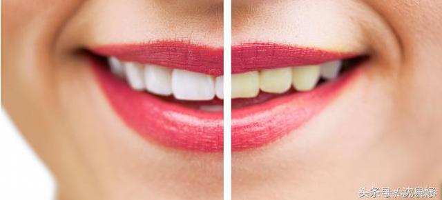 每天刷牙牙齿还黄？学会这些是美白牙齿的关键