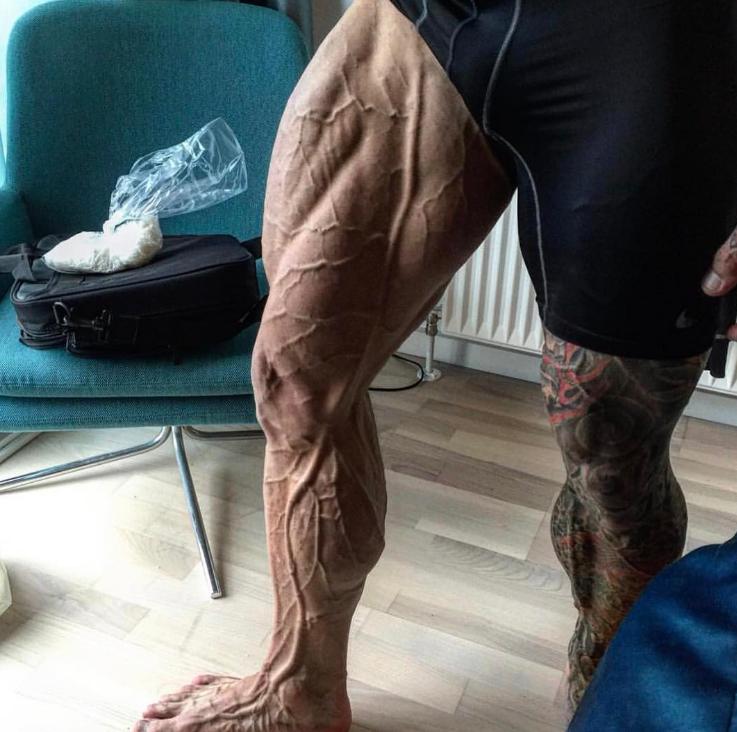 股四头肌，不只是健身爱好者的事，应该所有人都该加强锻炼！