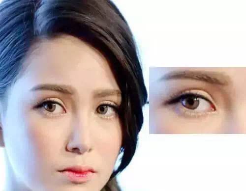 杨幂眼皮松弛怎么补救的,杨幂眼睛肿了怎么回事