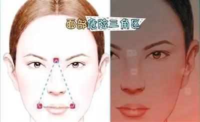 去黑头的秘诀都在这里,去黑头物品推荐清单