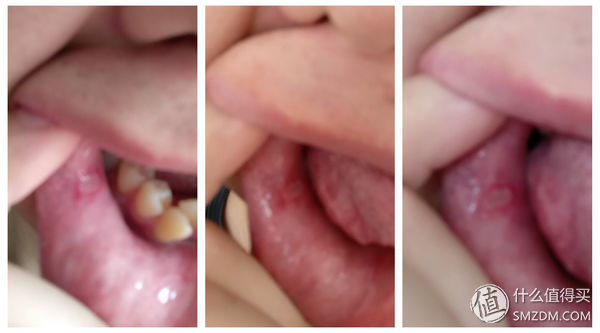 家庭医护小药箱,家庭急救小型药箱