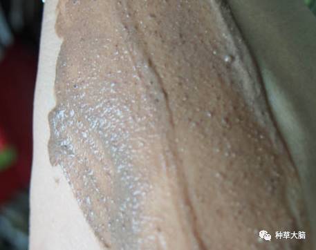 黑头白头能有效去除吗,一涂黑头就冒出来的面膜