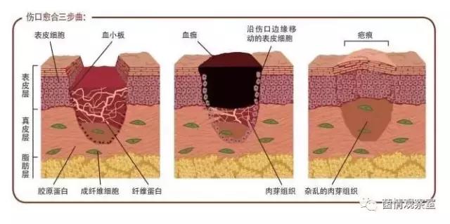 益生菌能不能帮助消炎,益生菌能修复细胞吗