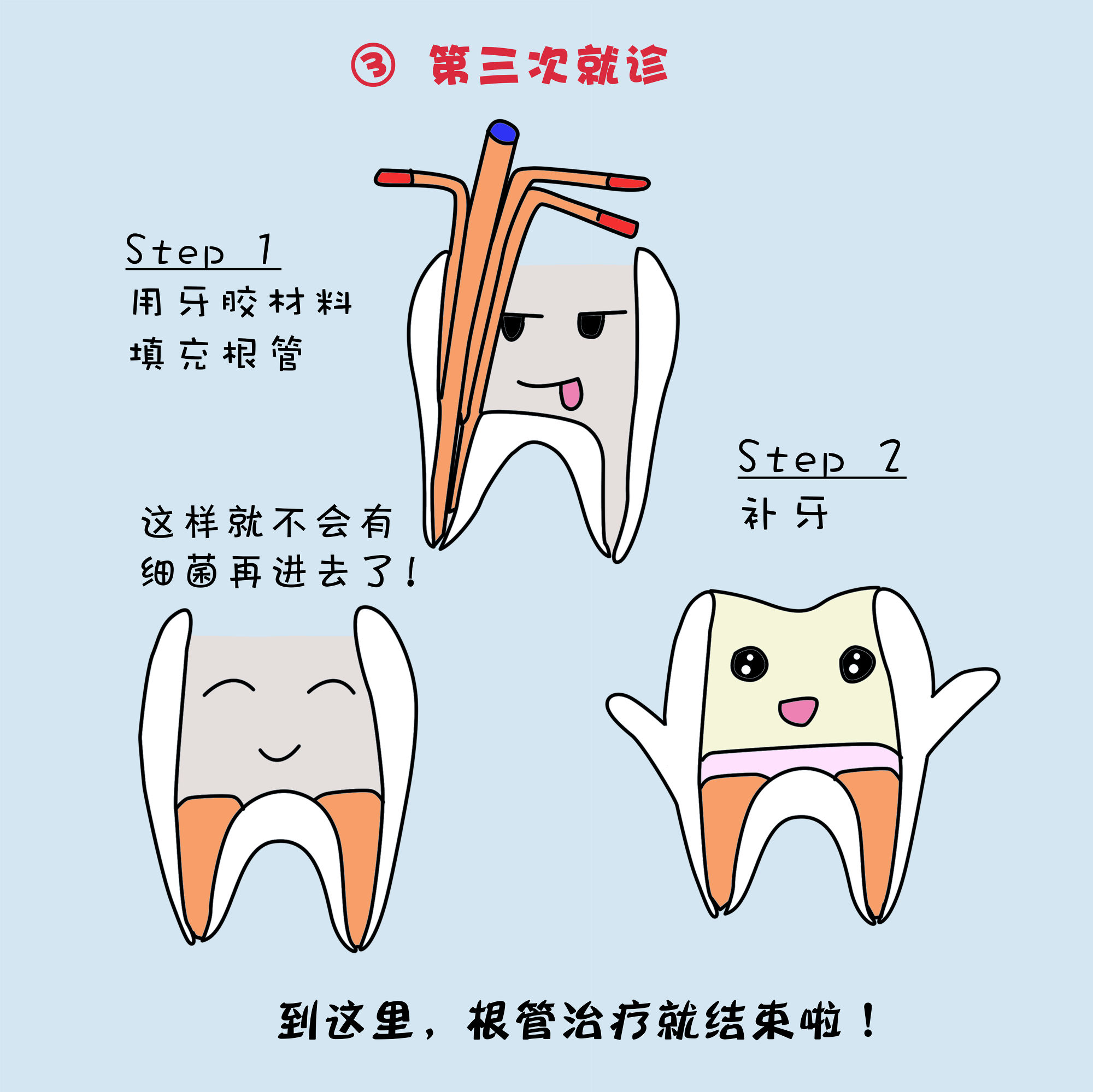 根管治疗是什么作用,根管治疗是什么情况下要做