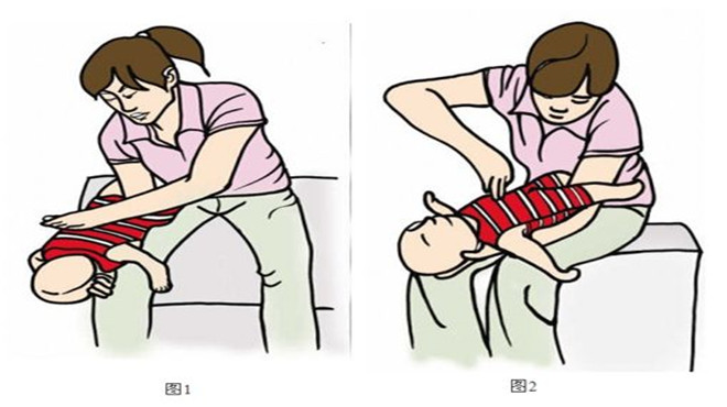 婴儿被异物卡住喉咙急救,小孩喉咙卡异物急救视频