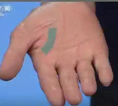 手是人体的重要器官,手的颜色能看出健康的问题吗