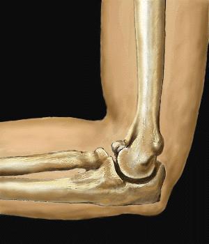 4岁左桡骨小头骨皮质断裂,小孩桡骨小头发育缺失