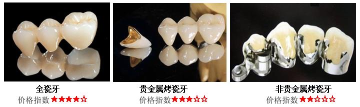 义齿知识普及,劣质义齿对身体有哪些害处