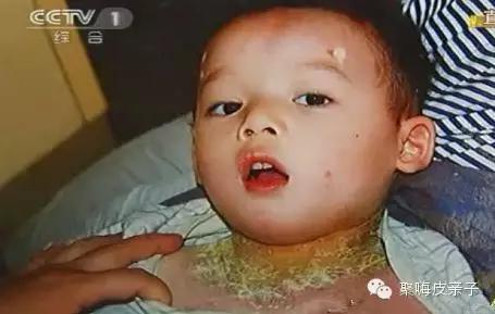 315点名婴儿产品,315晚会曝光产品名单儿童