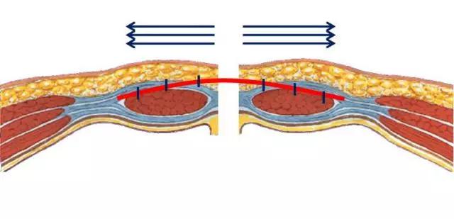 27次手术后的小男孩,男子手术后肚子里面又长了肿瘤