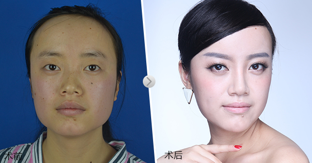 你眼里的丑也许是别人眼里的美,为什么别人很美而自己很丑