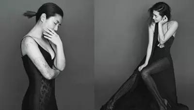 selina脸上的疤痕怎么修复,selina为什么脸部没有疤痕