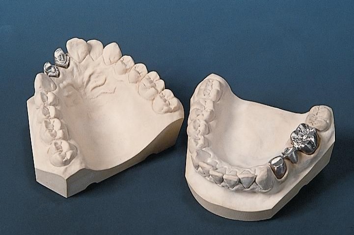 义齿知识普及,劣质义齿对身体有哪些害处