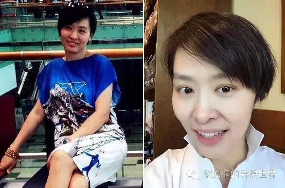 她们说||那些年整牙吞下的血和泪,终于换来最开怀的大笑