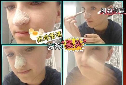 医生告诉你5个祛黑头的正确方法,试试这3招很有效的去黑头小妙招