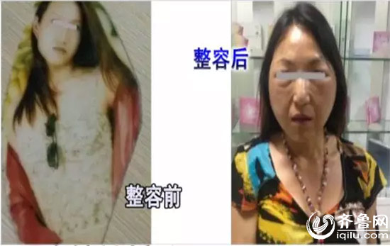 济南面部微整学校,济南微整提升班