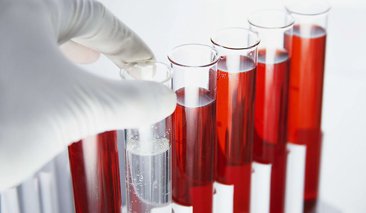 肾病治疗难易程度大排名，你会排第几呢？第一有点惨！