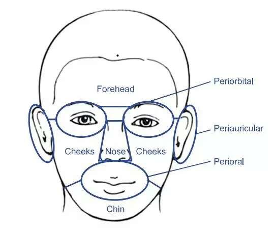 激素依赖性皮炎修复期什么样,激素依赖性皮炎怎么算彻底修复好