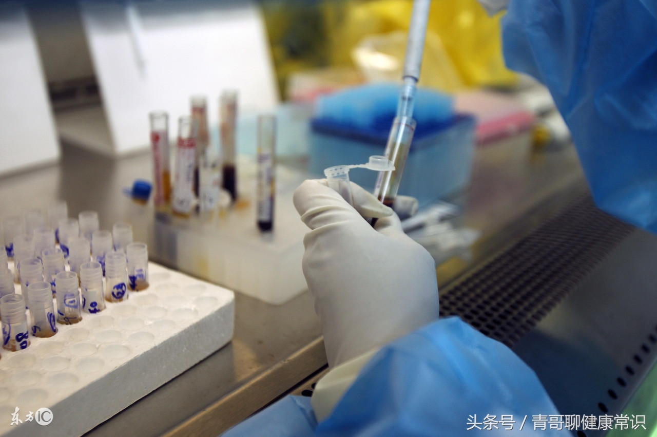 浅谈艾滋病的预防八百字论文,美国艾滋病窗口期