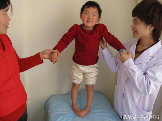 脑瘫儿最好的恢复情况,现在都是怎么处理脑瘫儿的