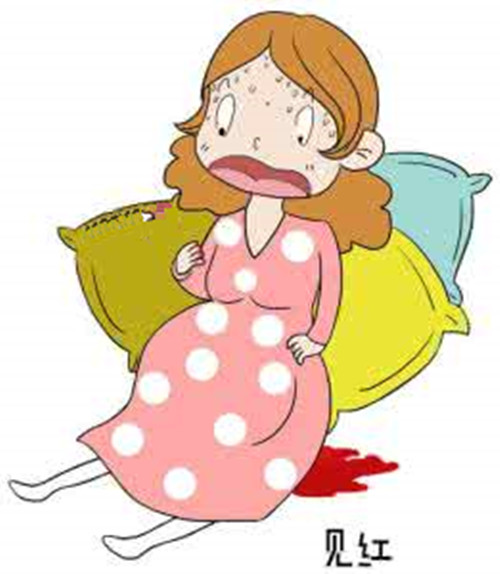 临产前的三大征兆是什么,临产前最准确的征兆要同时出现吗