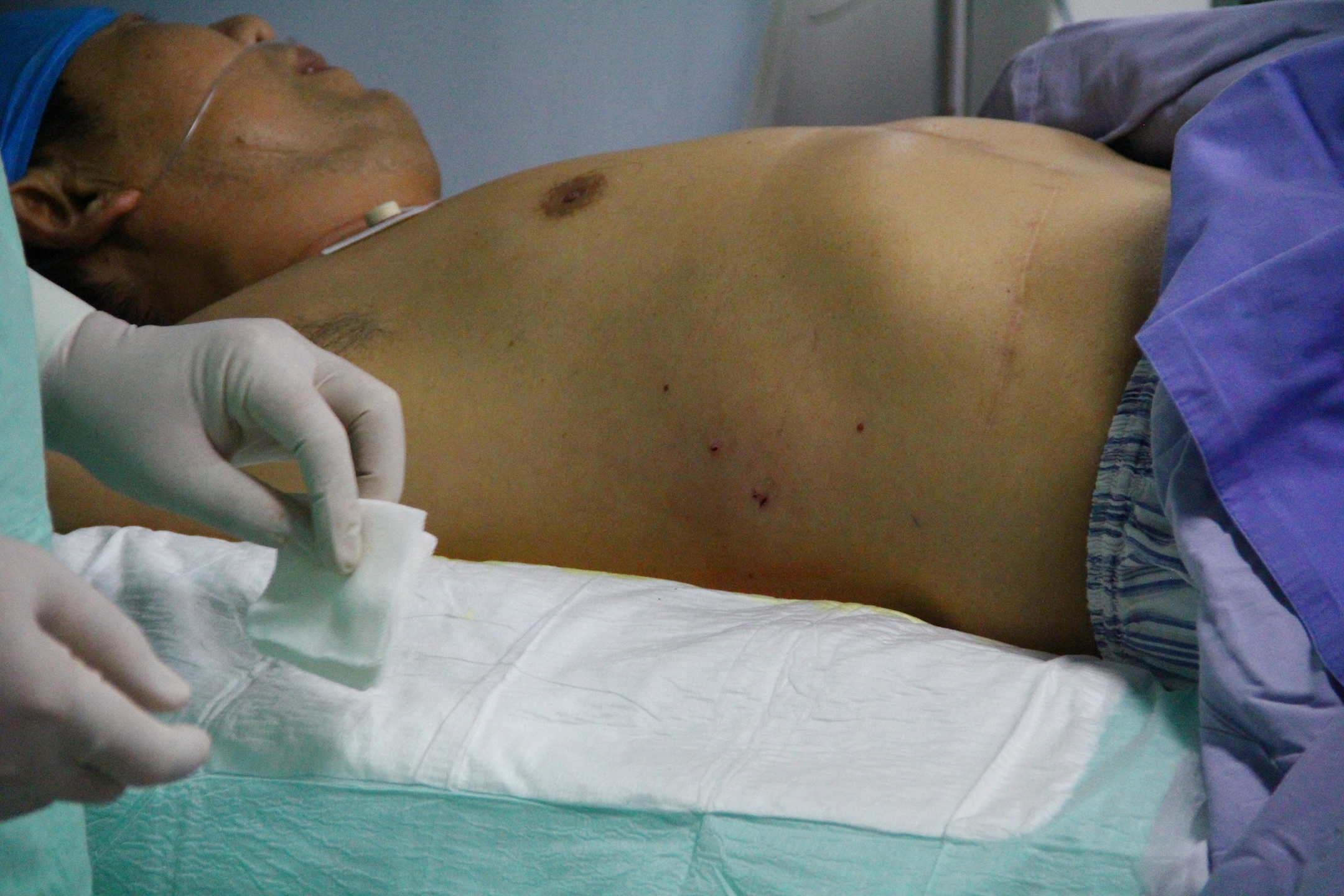 一带一路▪肿瘤微创健康中国行公益活动助肝癌患者重回健康