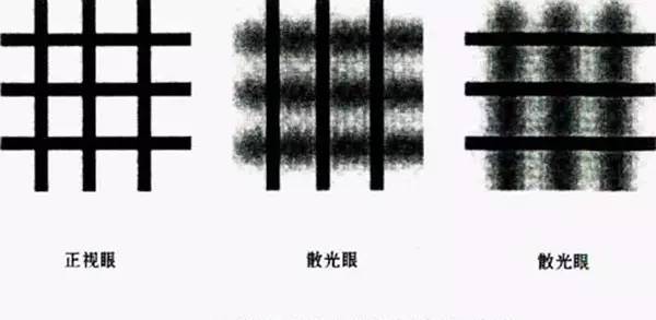 老生常谈的散光你真的了解全面吗,散光是角膜的问题还是晶状体问题