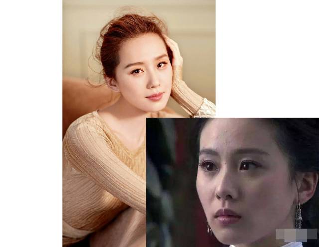 粉刺黑头去除最快方法,鼻子螨虫黑头怎么去除简单方法