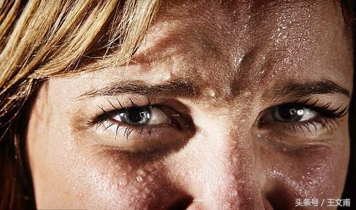 摆脱色粉,摆脱斑点和暗黄