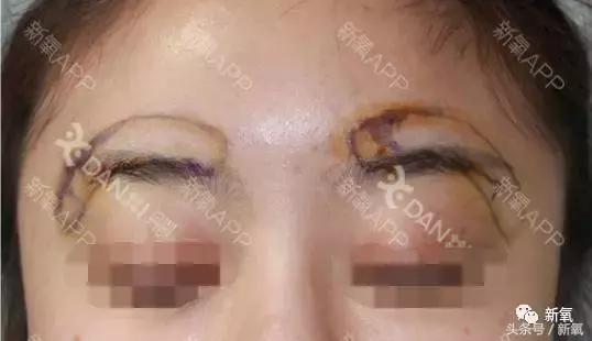 杨紫微整前后容颜对比,杨紫瘦了吗