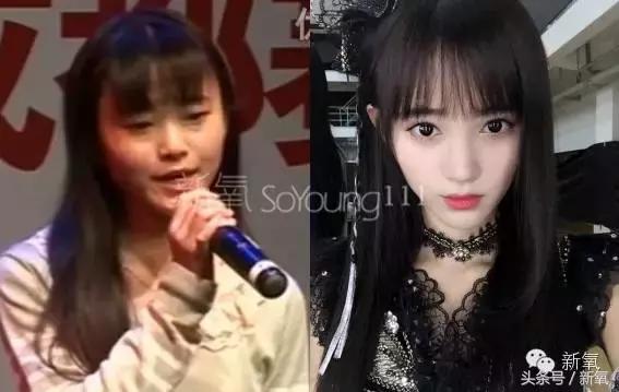 杨紫微整前后容颜对比,杨紫瘦了吗
