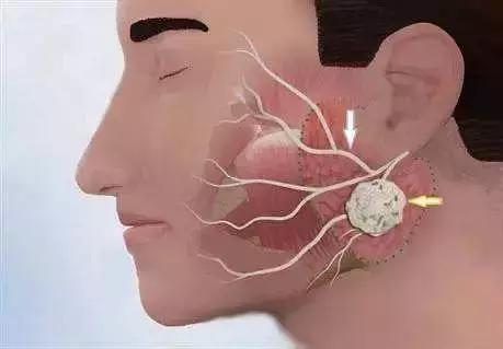 右眼皮一直跳是跳财还是跳灾,最近一直左眼皮跳预示着什么