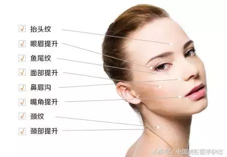 线雕面部提升女的,少女线雕术