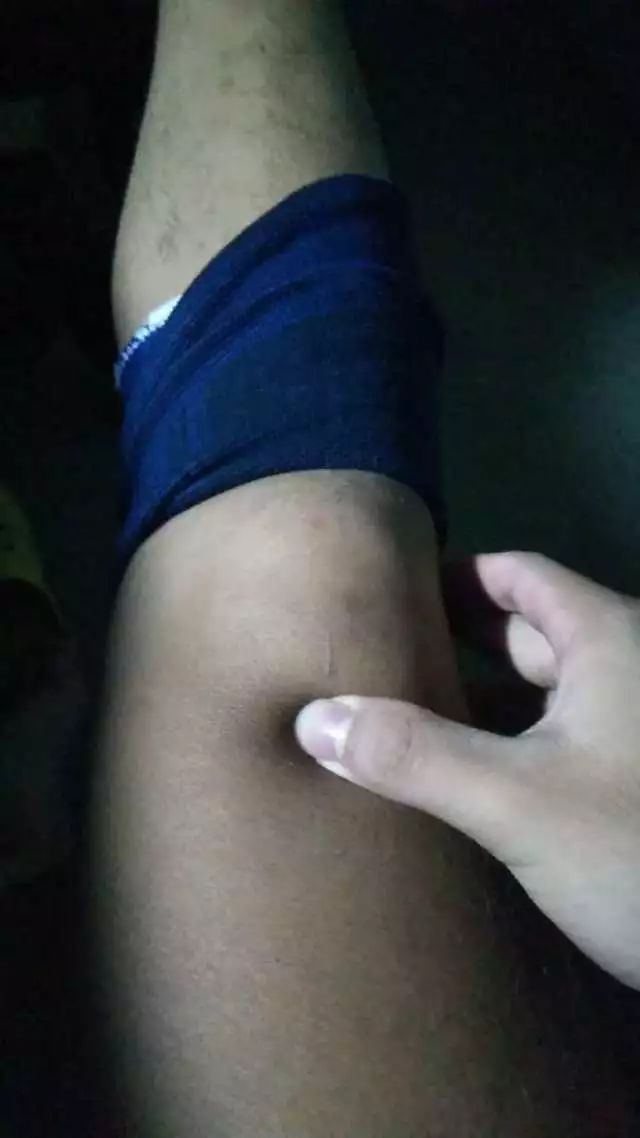 网球肘详细讲解,如何发力避免网球肘