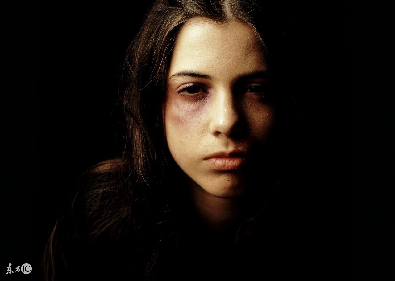 黑眼圈20年了怎么消除,40岁黑眼圈怎么内外调理