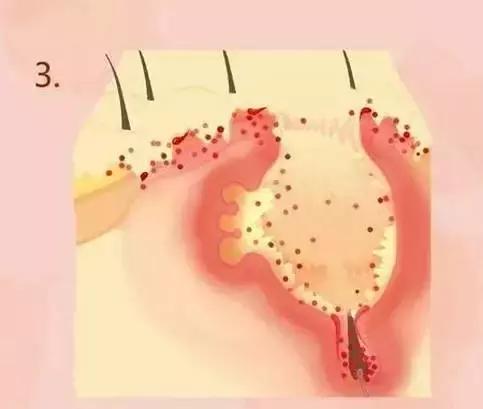 啊！没错，我今天要拯救你们的脸于水火之中！