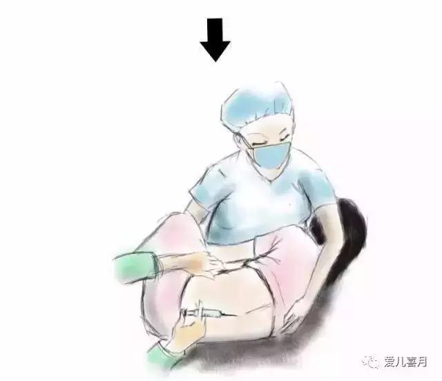 如何画剖腹产,什么是剖腹产手绘画