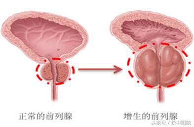 男人过了30岁感觉身体哪哪都是病,男人30岁什么病都出现了