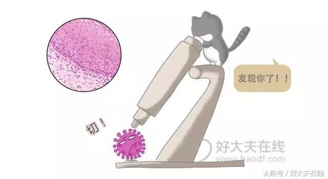 hpv阳性患者自述症状,感染hpv者自述症状