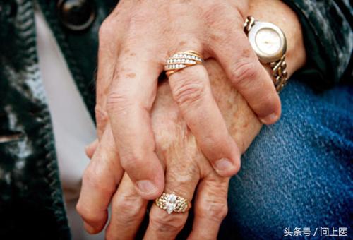 类固醇类药物是什么药,类固醇类药物有什么作用