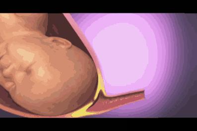 胎儿入盆及分娩过程模拟,怀胎十月分娩