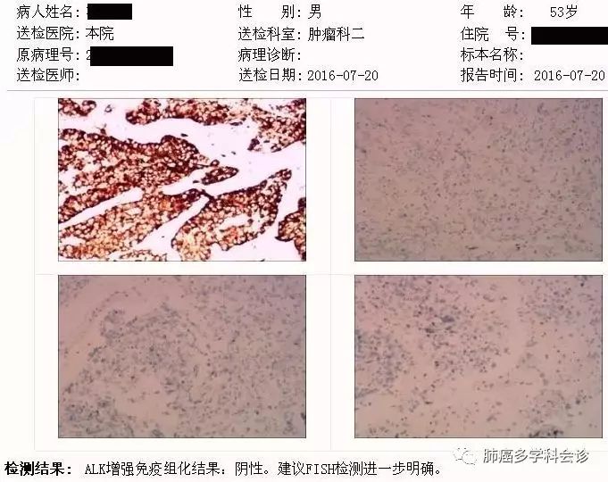 肺癌krasg12d基因突变生存期,肺癌krasg13c基因突变