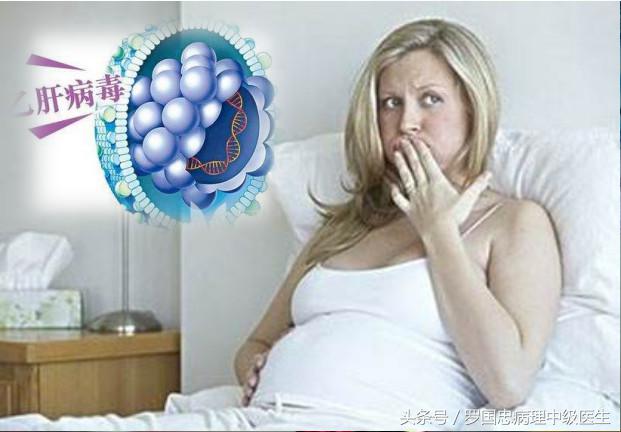 妊娠肝炎,肝炎的孕妇妊娠需要注意什么