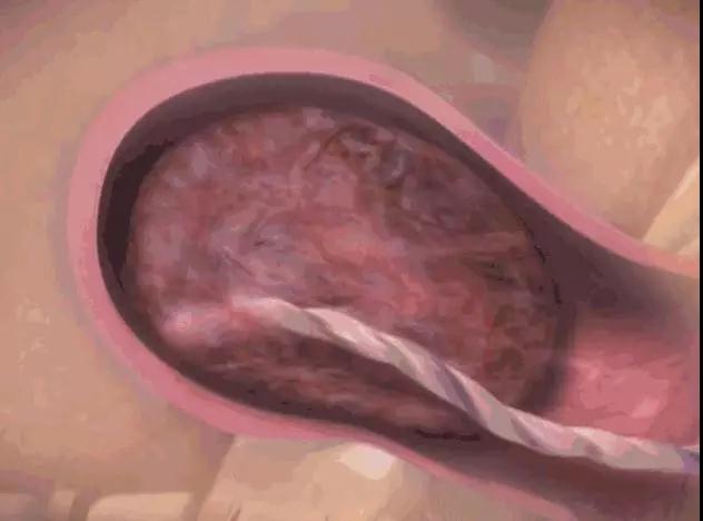 女人生孩子到底有多痛？高清动图看到腿软！