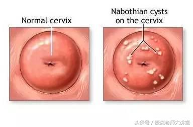 每个女生都得知道的6项妇科检查,妇科体检表有哪些项目