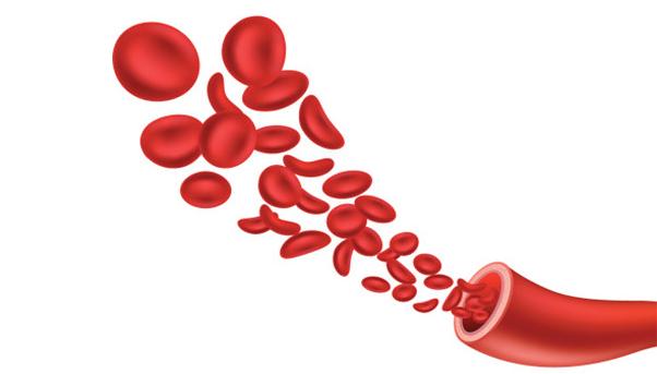 缺铁性贫血吃什么食物补血最快最好,孕妇贫血吃什么食物补血最快