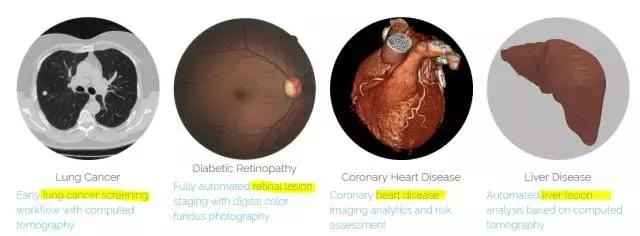 腾讯ai医疗窘境,腾讯投资中国ai医药公司