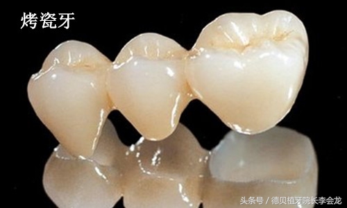 做了烤瓷牙还能换活动义齿吗,做了烤瓷牙还能戴矫正牙套吗