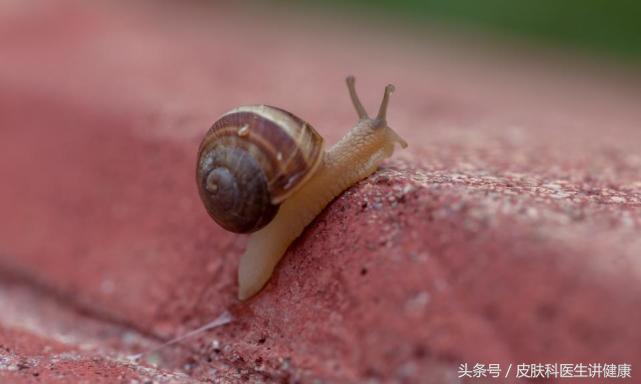 梅毒和银屑病怎么这么像,梅毒伪装成银屑病