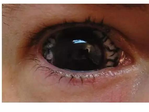 全世界奇葩美瞳,盘点那些奇葩美瞳